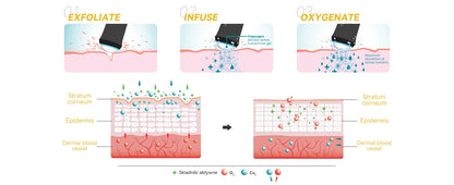 Portable CO2 Oxygen Bubble Pen Rechargeable Facial Exfoliate Device