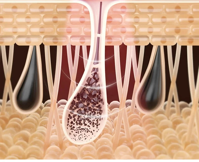 999,999 Flashes IPL Laser Epilator for Painless Home Hair Removal