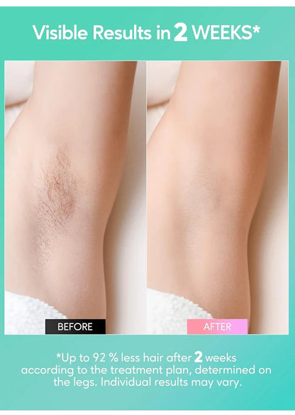 999,999 Flashes IPL Laser Epilator for Painless Home Hair Removal